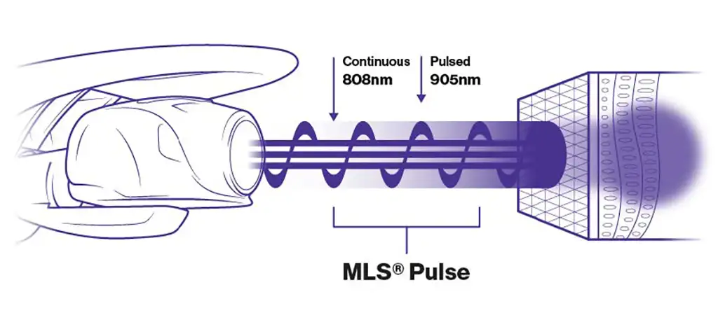 MLS Laser pulse diagram
